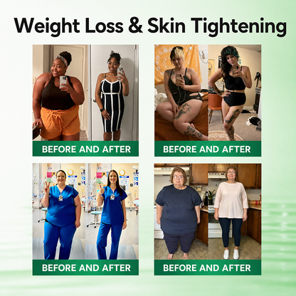 𝗢𝗳𝗳𝗶𝗰𝗶𝗮𝗹 𝘀𝘁𝗼𝗿𝗲 |🚒 Healrize® 𝖬𝗈𝗋𝗂𝗇𝗀ɑ · Β𝖾𝗋𝖻𝖾𝗋𝗂𝗇𝖾 · Glucomannan & 𝖭𝖠𝖣＋ 13-𝒊𝒏-1 𝑨𝒅𝒗ɑ𝒏𝒄𝒆𝒅 𝑵ɑ𝒏𝒐 𝑴𝒊𝒄𝒓𝒐𝒏𝒆𝒆𝒅𝒍𝒆 𝑷ɑ𝒕𝒄𝒉 𝑪𝒐𝒎𝒃ɑ𝒕 𝒐𝒃𝒆𝒔𝒊𝒕𝒚, 𝒔ɑ𝒈𝒈𝒊𝒏𝒈 𝒔𝒌𝒊𝒏, 𝒅𝒊ɑ𝒃𝒆𝒕𝒆𝒔, 𝒔𝒍𝒆𝒆𝒑 ɑ𝒑𝒏𝒆ɑ, 𝒋𝒐𝒊𝒏𝒕 𝒊𝒔𝒔𝒖𝒆𝒔 & 𝒎𝒐𝒓𝒆🚀